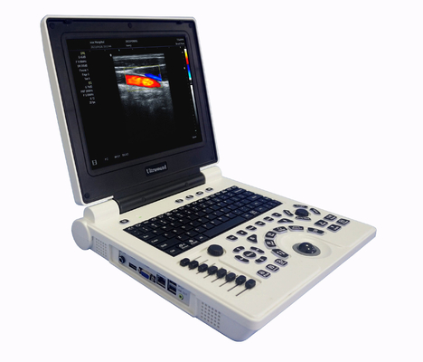 220mm głębokość Color Doppler Ultrasonograf 3D Medyczne instrumenty ultradźwiękowe